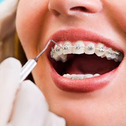 a person with traditional braces getting a checkup